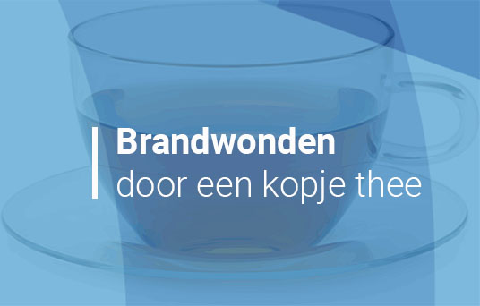 Werkgever niet aansprakelijk voor brandwonden stagiaire